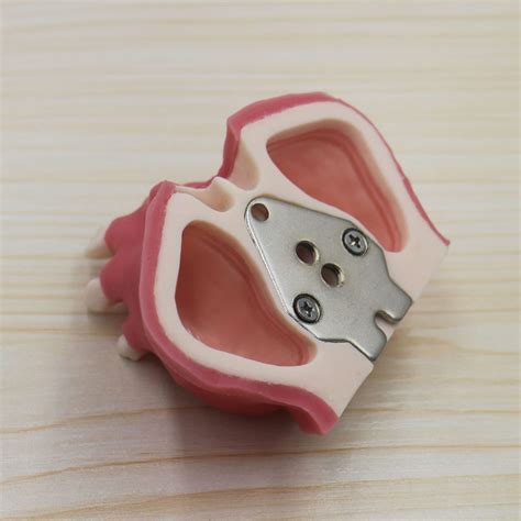 Image result for Model of Conduction