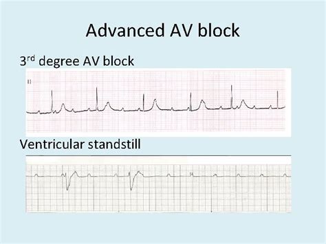 Image result for ACLS Code Blue Algorithm