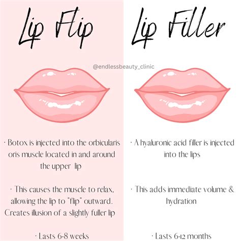 Lip Flip vs Lip Filler | Lip fillers, Botox fillers, Botox