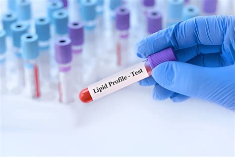 Book Lab Test in Delhi | Blood Test Price at Home in Delhi | H.R ...