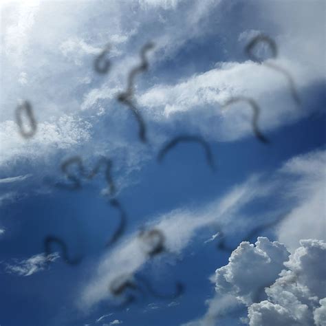 Image result for Eye Floaters Under Microscope