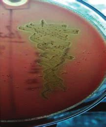 Image result for Enterococcus Faecalis Hemolytic Activity