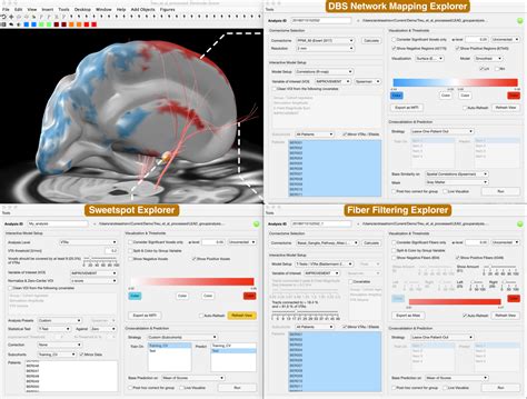 Image result for DBS Tutorial
