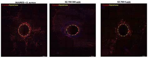 Targeted Antibacterial Endolysin to Treat Infected Wounds on 3D Full ...