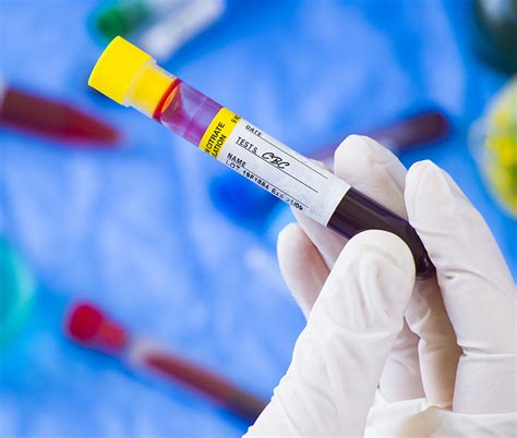 CBC Lab Panel 的图像结果