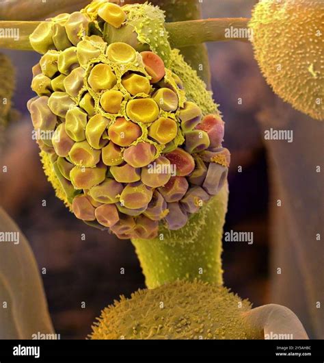 Bread mould. Coloured scanning electron micrograph (SEM) of a black ...