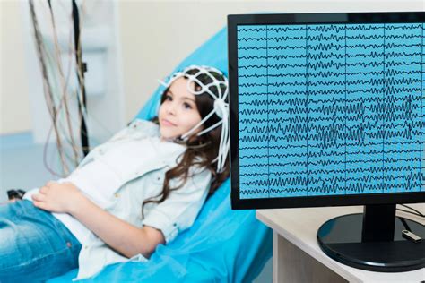 Sleep Deprived EEG | MediServices Healthcare Ltd.