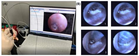 Flexible-Imaging-Fiber-Guided Intratracheal Intubation in Rodents
