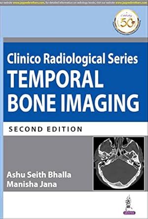 Buy Clinico Radiological Series: Temporal Bone Imaging Book Online at ...