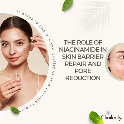 Does Niacinamide Cause Purging or Acne Breakout?