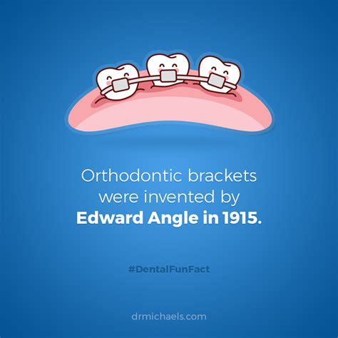 When Were Braces Invented at Bev Wood blog