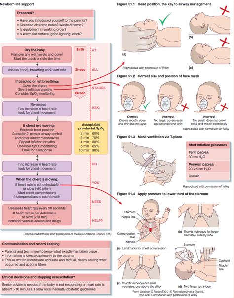 Image result for Neonatal Resuscitation Algorithm Steps