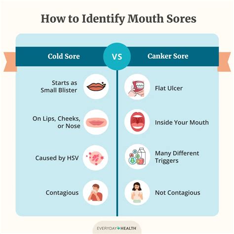 Cold Sore vs. Canker Sore: Understanding the Difference