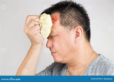 Man Treating His Injured Painful Swollen Forehead Bump with Icepack Stock Image - Image of face ...