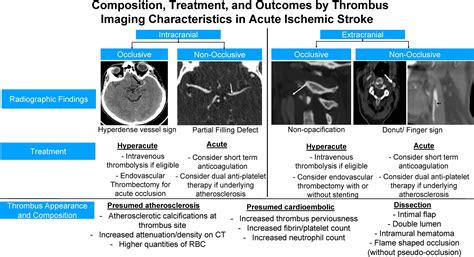 Composition, Treatment, and Outcomes by Radiologically Defined Thrombus Characteristics in Acute ...
