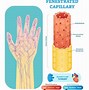 Image result for capillaries