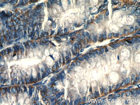 PLP2 antibody (21482-1-AP) | Proteintech