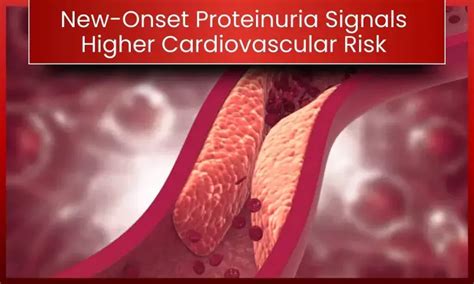 New-Onset Proteinuria (NOP) During Hospitalization: A Critical ...