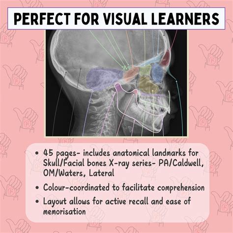 Skull X-ray Anatomy, Pa/caldwell, Om/waters & Lateral, 2025 Radiography ...