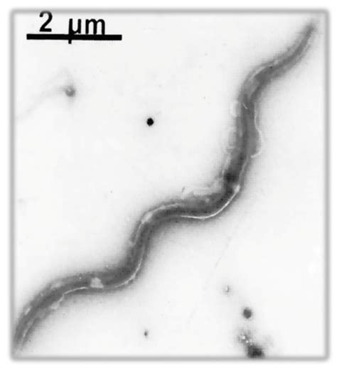 Borreliae Part 1: Borrelia Lyme Group and Echidna-Reptile Group