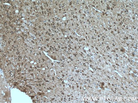 Caspase 3/P17/P19 antibody (19677-1-AP) | Proteintech