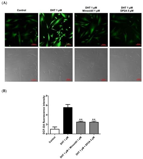 Anti-Hair Loss Effects of the DP2 Antagonist in Human Follicle Dermal ...