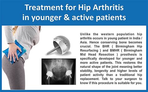 Dr. Santosh Kumar, Best Orthopedic Surgeon in Kolkata, India | Robotic ...