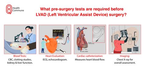 A Quick Guide to Left Ventricular Assist Device (LVAD) – Health Commune