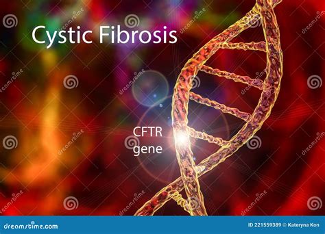Cystic Fibrosis Types Of Mutations at Megan Cisneros blog