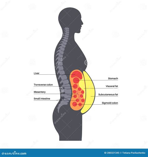Visceral fat diagram stock vector. Illustration of medical - 280321345