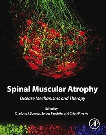 Spinal Muscular Atrophy: Disease Mechanisms and Therapy eBook : Sumner ...