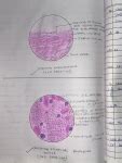 DIAGRAMS TUMOR OF ODONTOGENIC TUNOUR I – Dentowesome