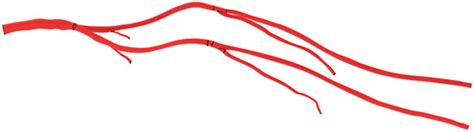 Preventing Acute Limb Ischemia during VA-ECMO—In Silico Analysis of ...