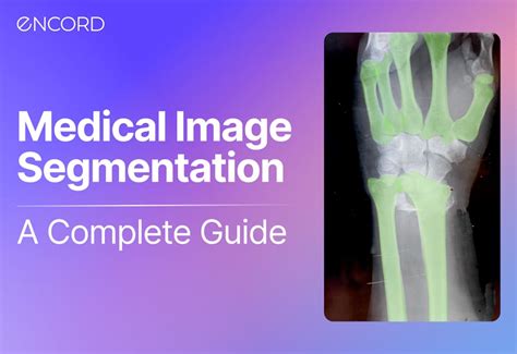 Image result for Medical Image Detection Segmentation Classification
