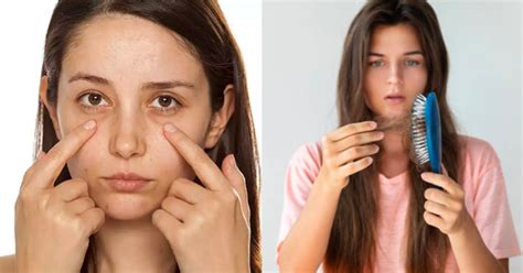 Iron Deficiency: 18 संकेत जो बता रहे हैं कि हमारे शरीर में हो रही है ...