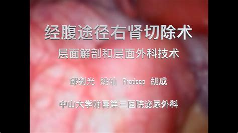 Image result for Simple Nephrectomy