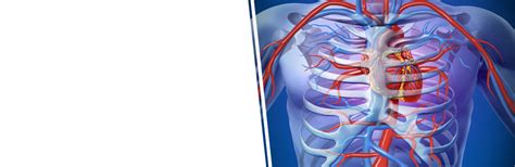 When to discharge a patient after primary PCI? | FAQ answered by Dr ...