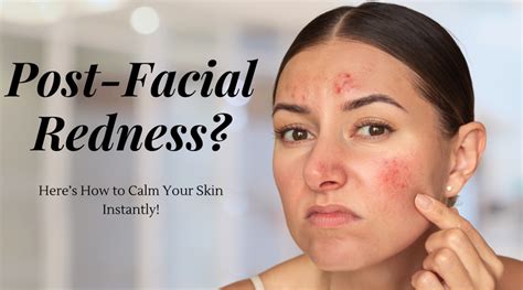 Post-Facial Redness? Here’s How to Calm Your Skin Instantly – Amantyacare