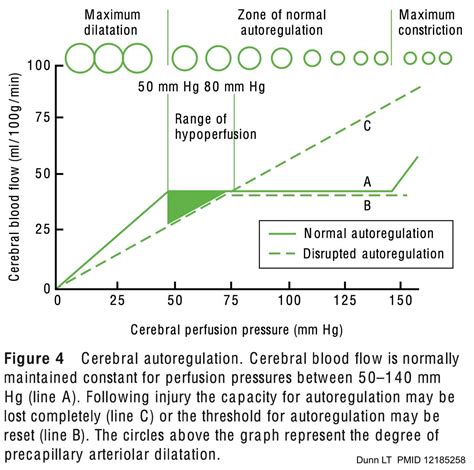 Elevated intracranial pressure (ICP) - EMCrit Project