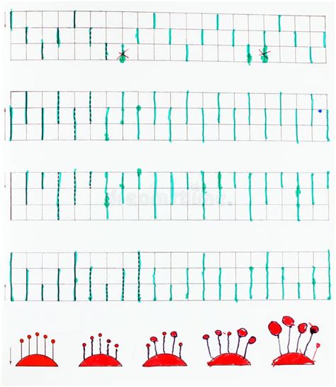 Image result for Exercise of Pattern