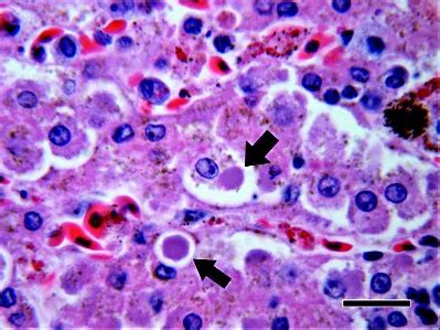 Image result for Monocyte Electron Microscope