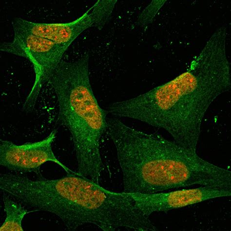 Core Algorithm Vector 的图像结果