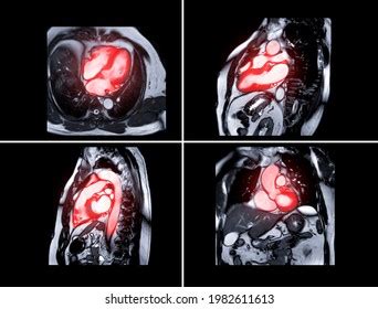 Image result for Heart with Name Using Python