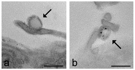 Transmission Electron Microscopy as a Powerful Tool to Investigate the ...
