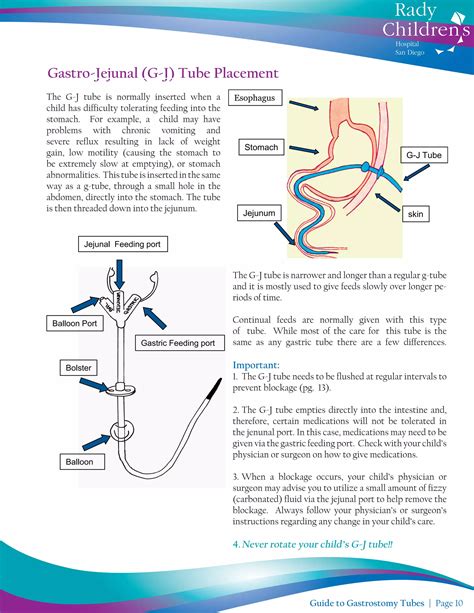 Guide to Gastrostomy Tubes | PDF