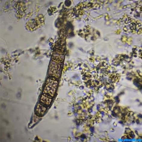 不太肯定的交链孢霉属再度来袭 - 微生物镜检 - 污托邦社区