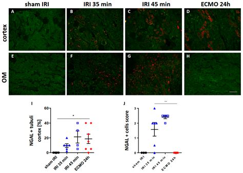 Different Acute Kidney Injury Patterns after Renal Ischemia Reperfusion ...