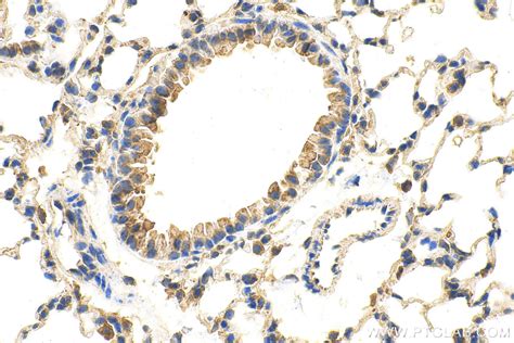 ADRB1 antibody (28323-1-AP) | Proteintech