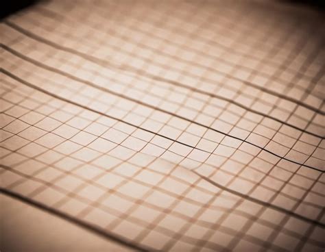 Image result for Dr Eppley Grid Pattern