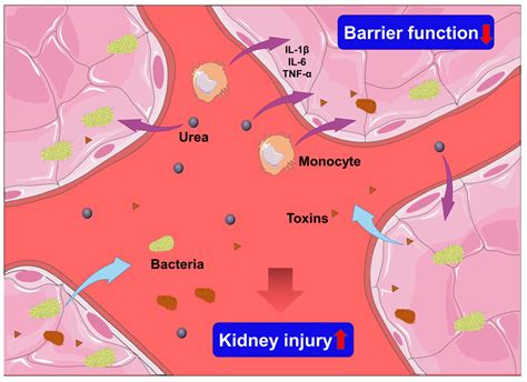 Organ Crosstalk in Acute Kidney Injury: Evidence and Mechanisms